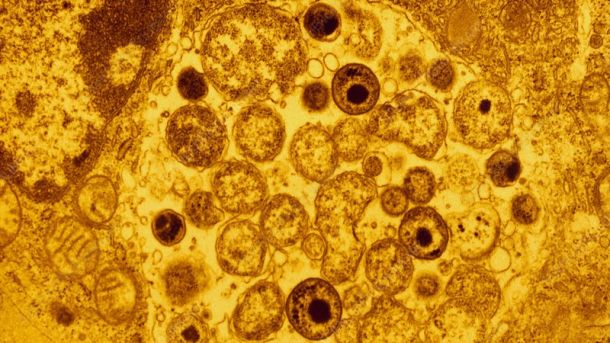 Malattie guano piccioni: elenco rischi e patologie