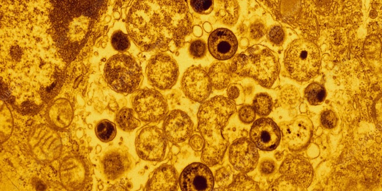 Malattie guano piccione-chlamydia